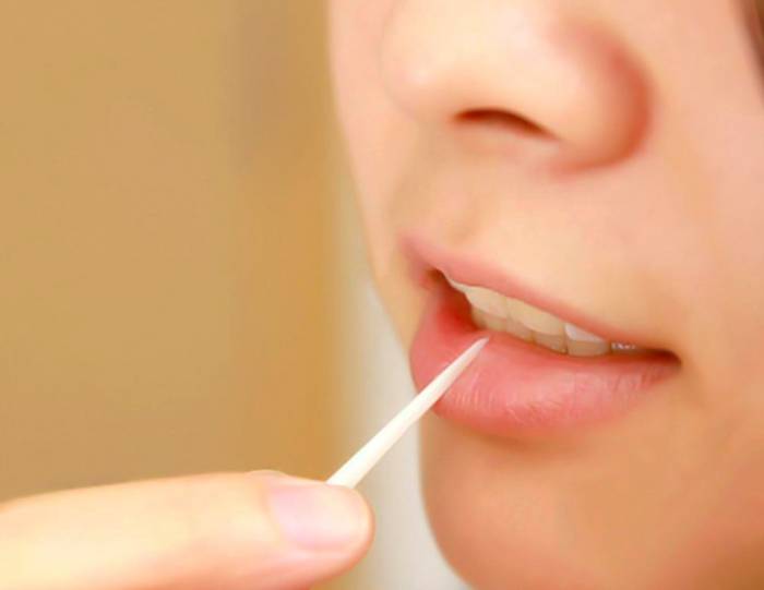 ضرر های خلال دندان