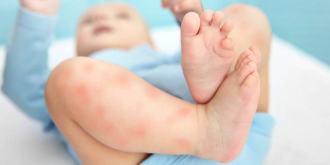 گال از چی به وجود میاد