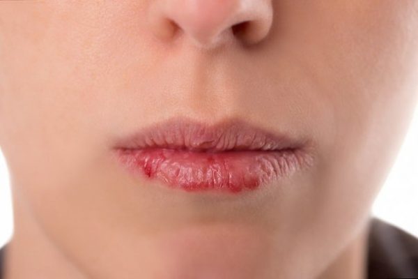 اسکراب لب با آسپیرین