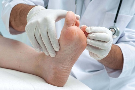 تشخیص عفونت ناخن پا, درمان عفونت ناخن پا, پماد برای عفونت ناخن پا