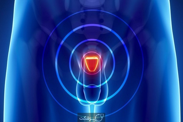 نکاتی در مورد انزال